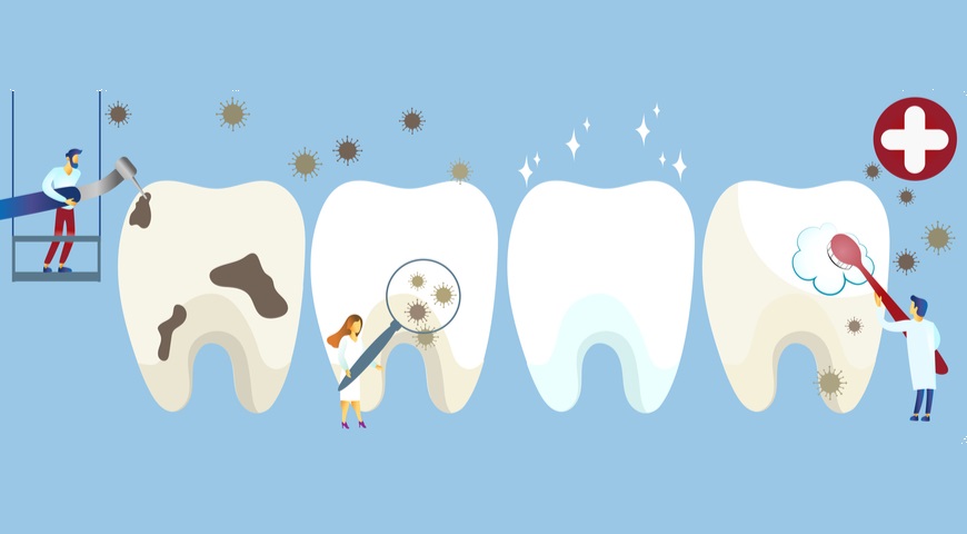 25 неожиданных фактов о зубах, и каждый – правда!